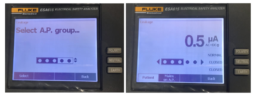 患者漏電(dian)流